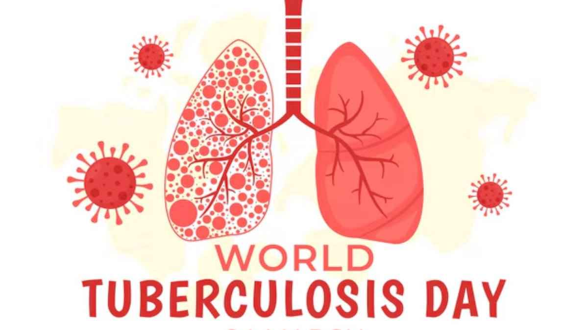 World TB Day: क्या टीबी से किडनी डिजीज का रिस्क बढ़ता है? एक्सपर्ट से जानें इस बारे में सबकुछ