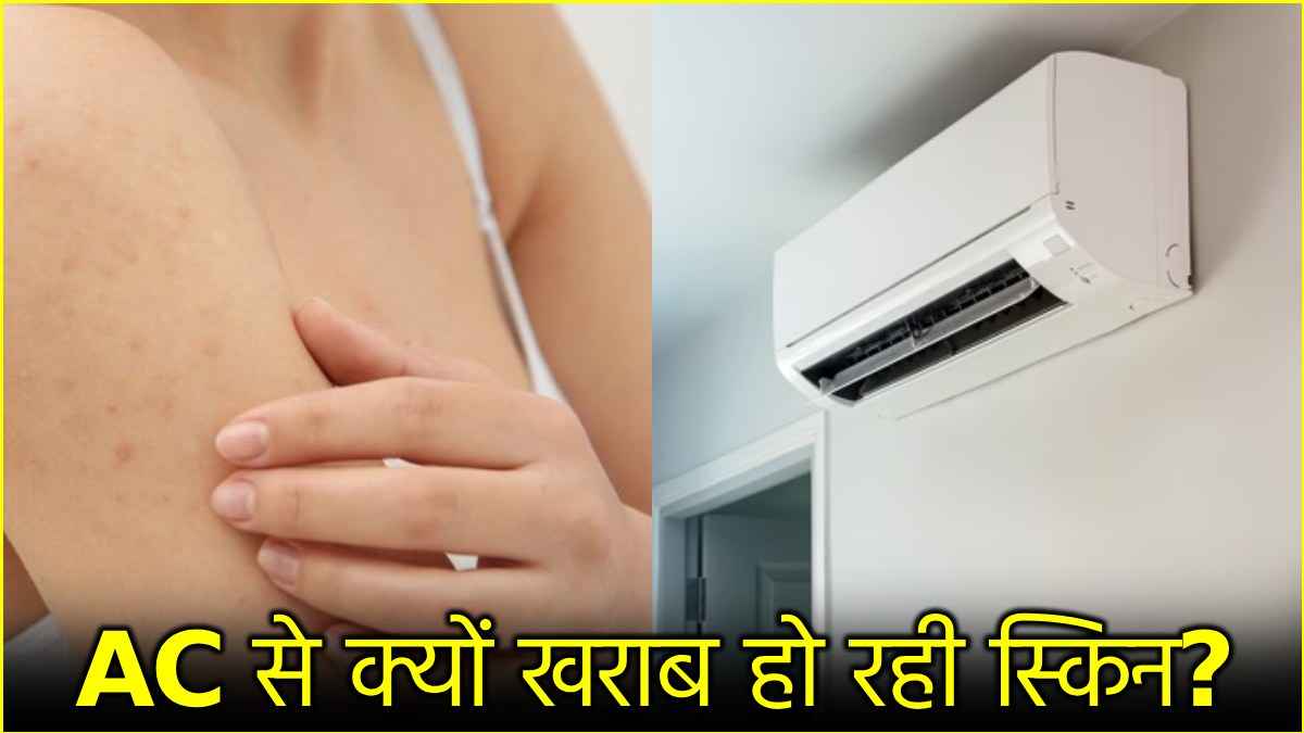 Ac side effects
