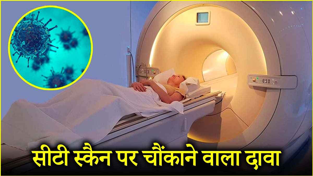 CT स्कैन से कैंसर का खतरा! अमेरिकन स्टडी मे चौंकाने वाला खुलासा, इन्हें ज्यादा रिस्क