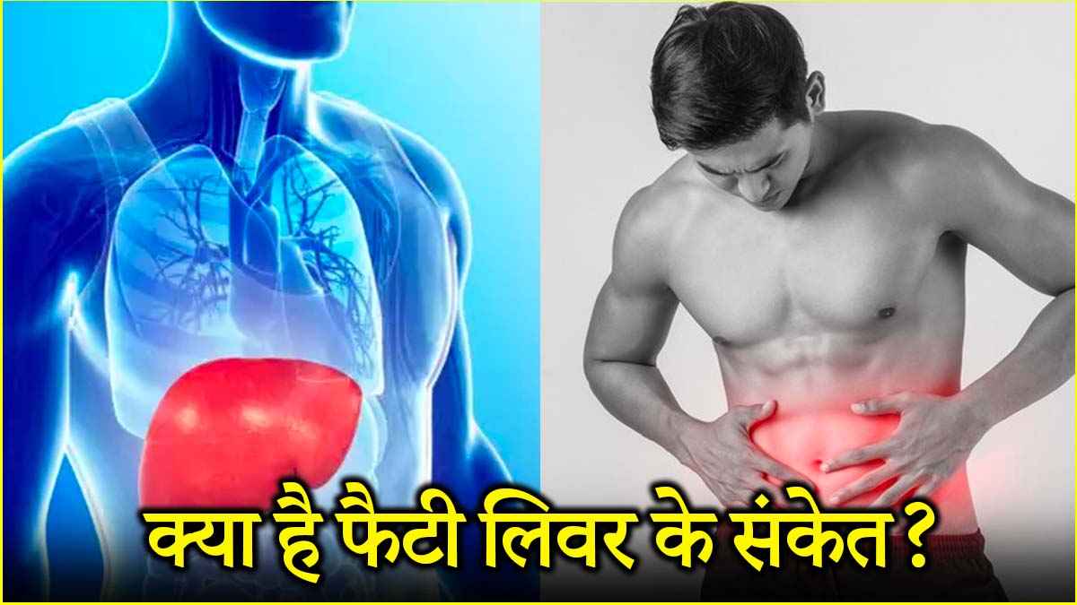 Fatty Liver Symptoms