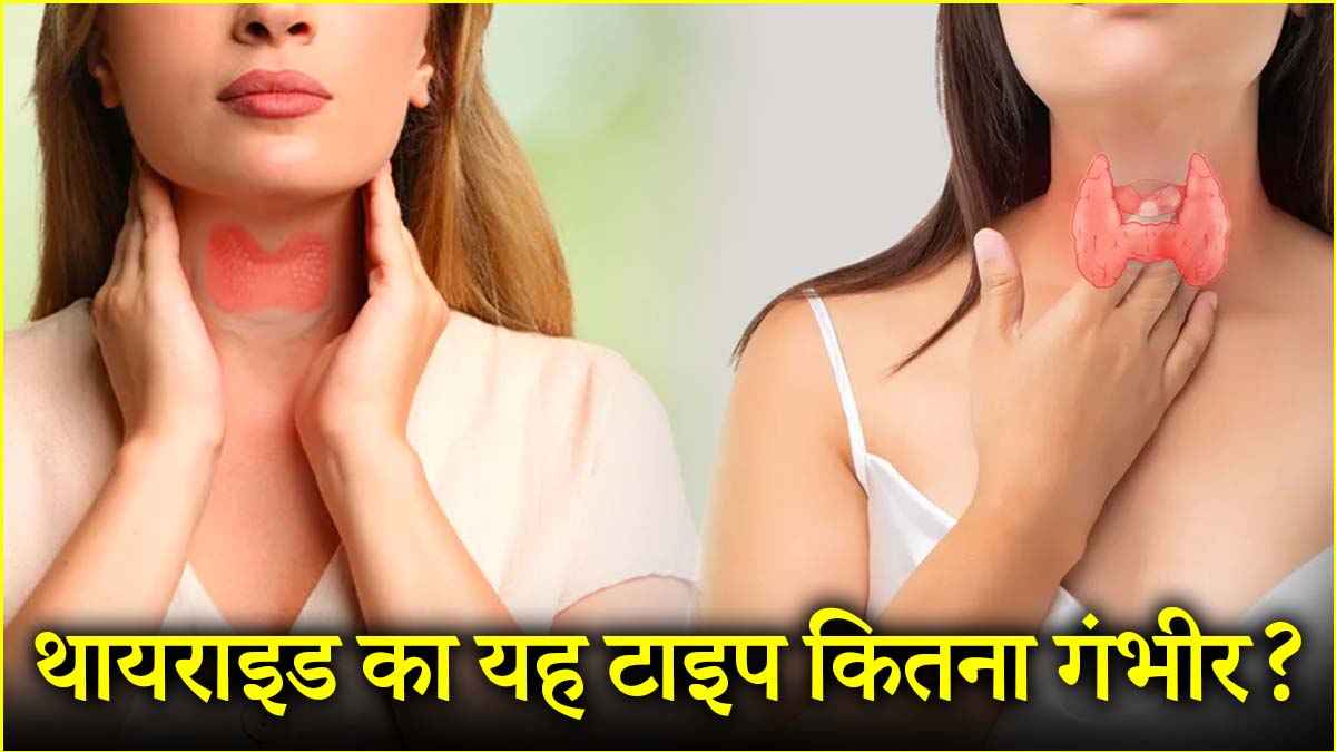 थायराइड के इन 5 संकेतों को इग्नोर न करें महिलाएं, घरेलू नुस्खे भी कारगर