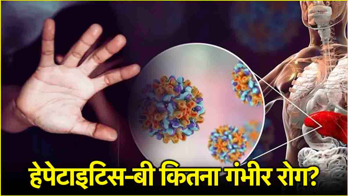 hepatitis