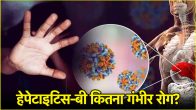 hepatitis