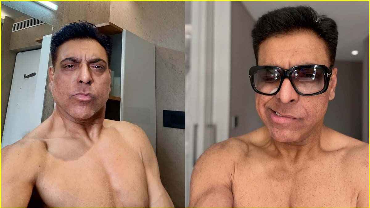 Ram Kapoor की सेमी न्यूड तस्वीरें देख चौंके फैंस, टेढ़े मुंह और पिचके चेहरे ने बढ़ाई चिंता