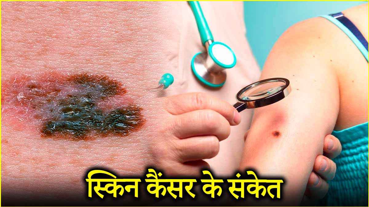 Skin Cancer Symptoms (1)