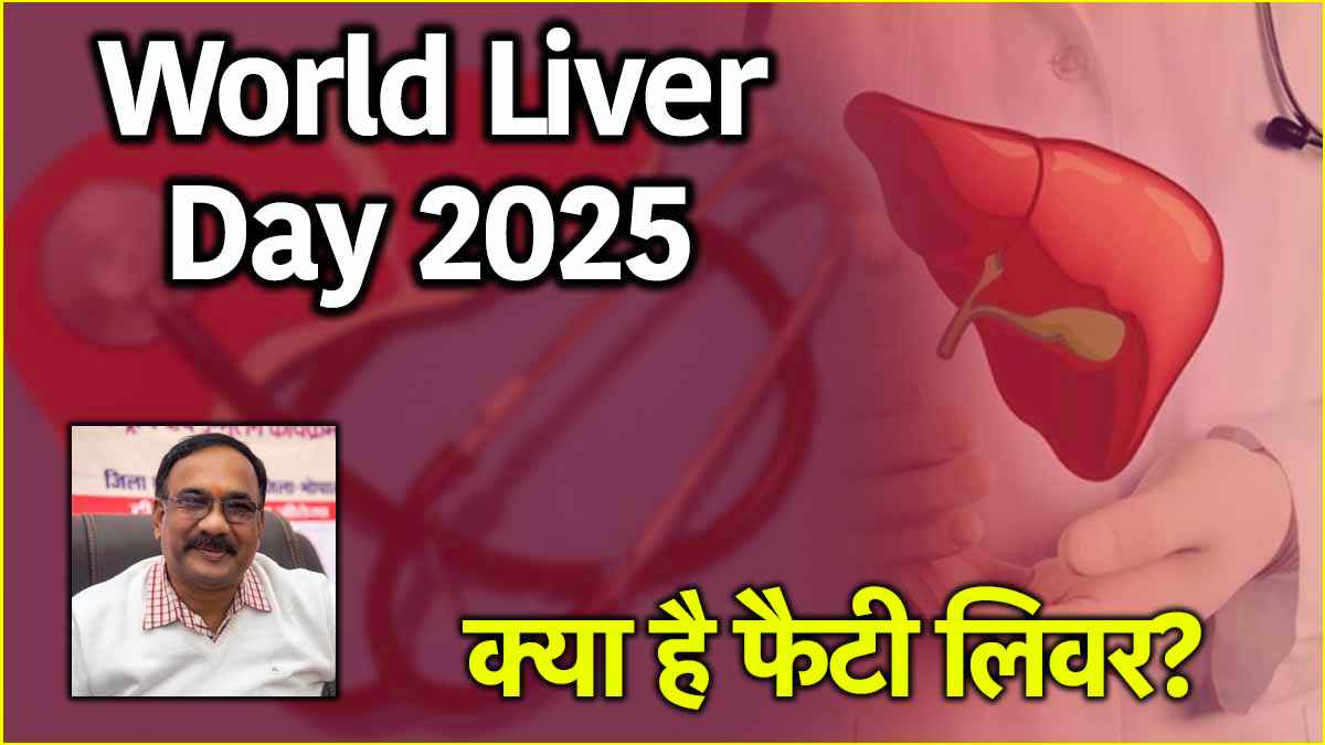 World Liver Day 2025: लिवर का बड़ा दुश्मन कौन? चीनी या शराब, जानें डॉक्टर की राय