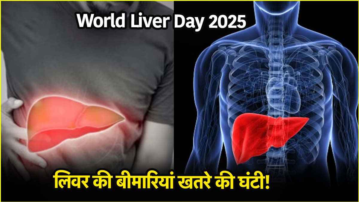 (World Liver Day 2025)