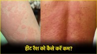 Skin Care Tips