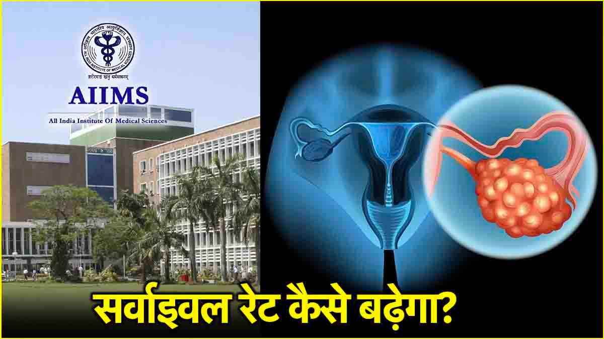 कैंसर पीड़ित महिलाओं की सर्जरी के बाद भी बढ़ेगी उम्र, AIIMS की रिसर्च में नया खुलासा
