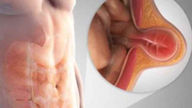 body lumps-1-2-3-4-5-6-7-8