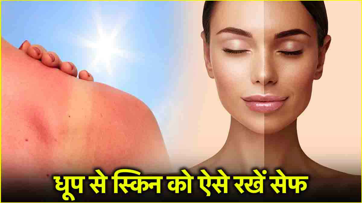 सनबर्न के शुरुआती संकेत क्या? जानिए बचाव के उपाय व उपचार