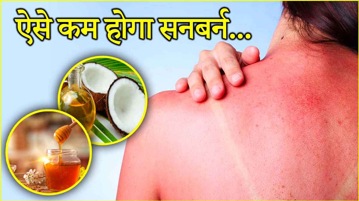 Skin Care Tips