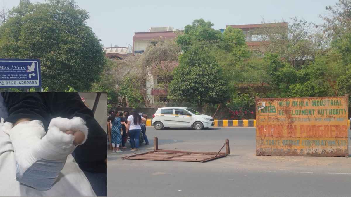 नोएडा ट्रैफिक पुलिस की लापरवाही से छात्रा का पैर टूटा, आरडब्ल्यूए की शिकायत को किया था अनसुना