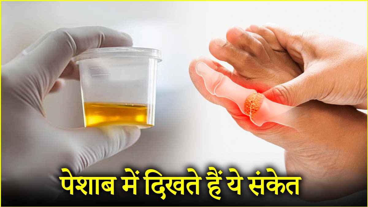 यूरिक एसिड ज्यादा हो तो पेशाब में दिखते 3 संकेत, जानें बचाव के तरीके