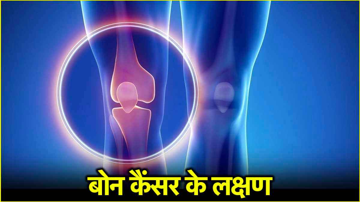 Bone Cancer Signs