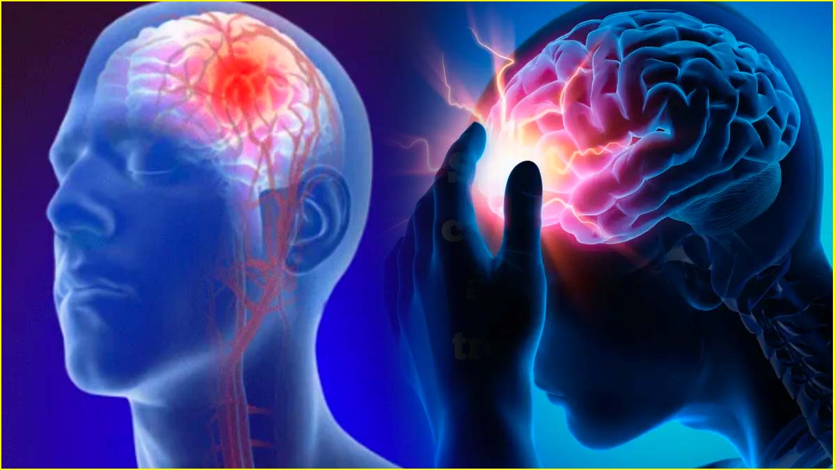 brain stroke causes brain stroke causes-1