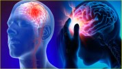 brain stroke causes
