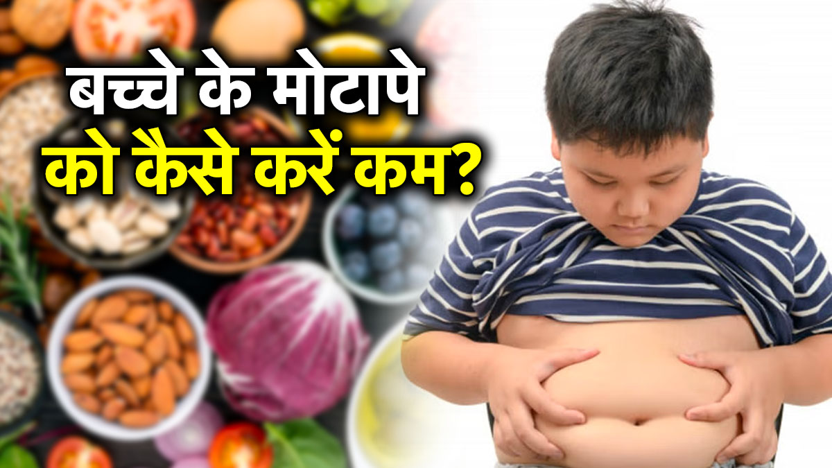 बच्चों में क्यों बढ़ रहा मोटापा, माता-पिता कैसे रखें उनका ध्यान? जानें क्या कहते हैं डॉक्टर