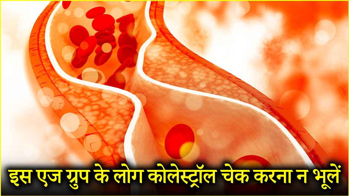 Cholesterol (6)