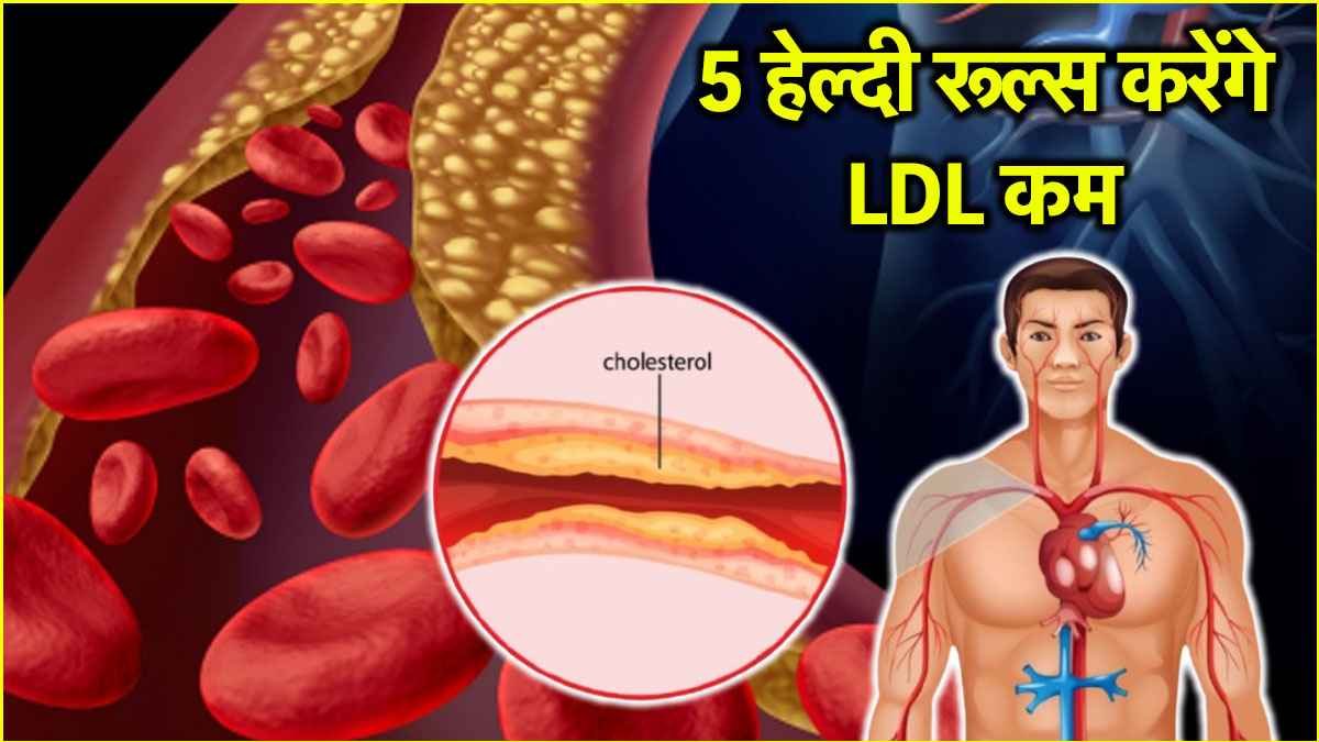 Cholesterol Control Tips