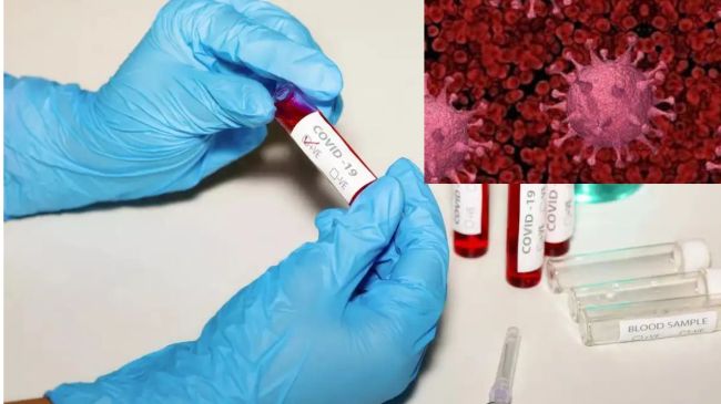 Ghaziabad News, COVID-19 Omicron variant, गाजियाबाद न्यूज, कोविड, कोरोना वायरस