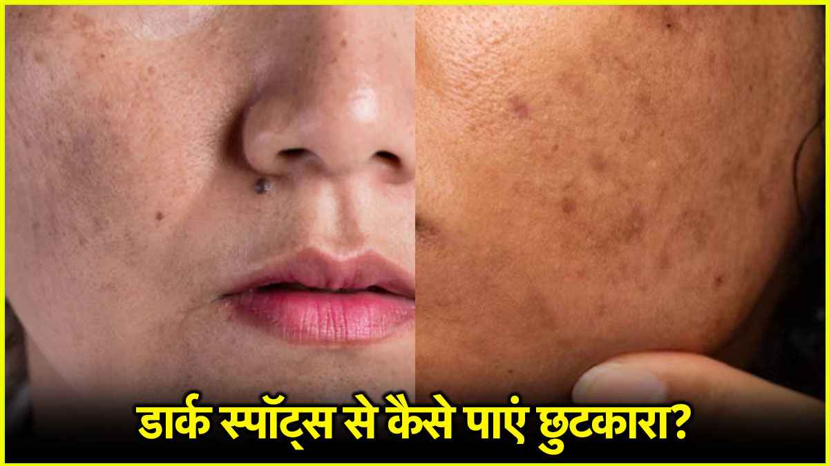 Skin Care Tips Skin Care Tips