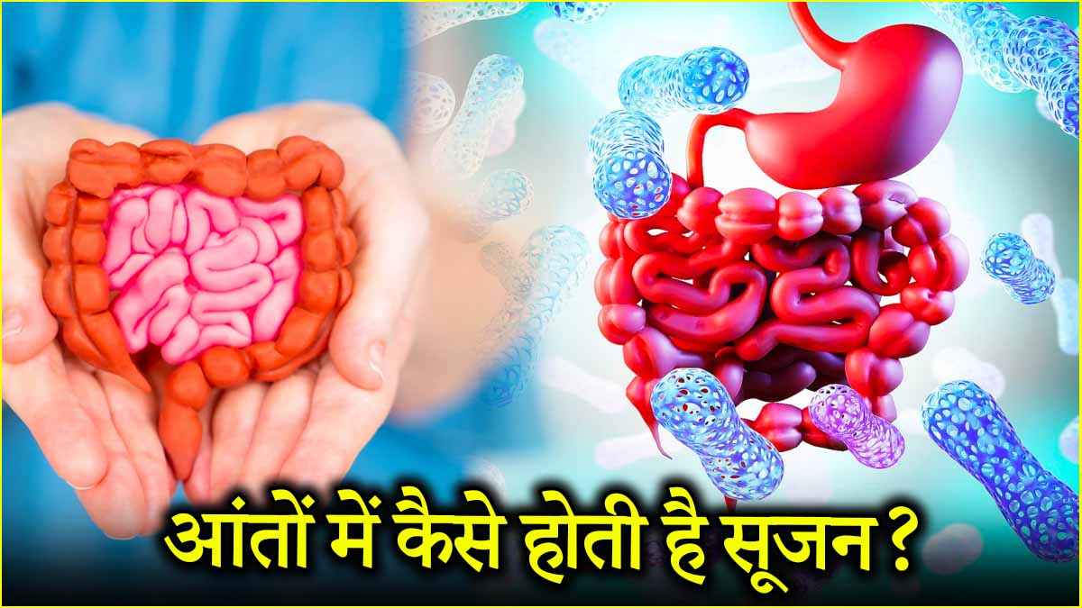 Gut Health (2)