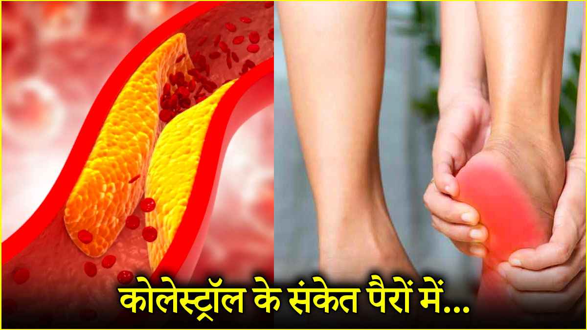 Cholesterol Symptoms: पैरों में दिखाई देते हैं कोलेस्ट्रॉल के 3 संकेत, क्या कहती है रिसर्च