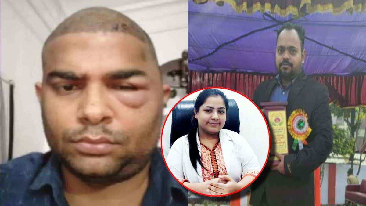 Kanpur Hair Transplant Case (1)