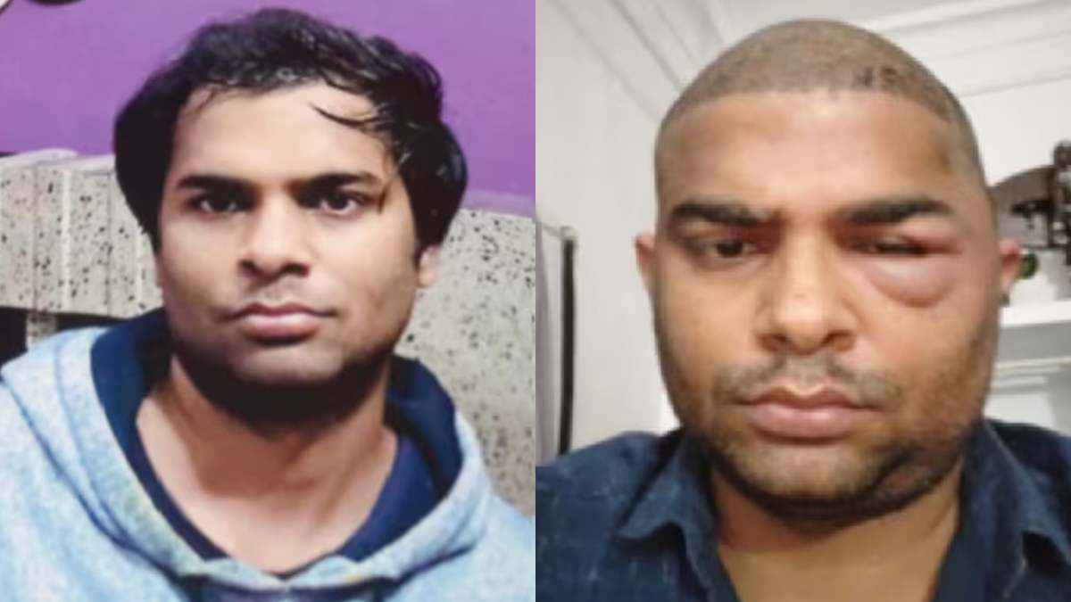 Kanpur Hair Transplant Case