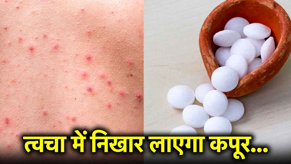 स्किन में निखार लाएगा कपूर, जानिए इसके 5 जबरदस्त ब्यूटी बेनिफिट्स