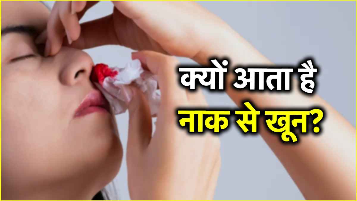 गर्मियों में आपकी भी नाक से आता है खून? ट्राई करें ये 5 टिप्स  