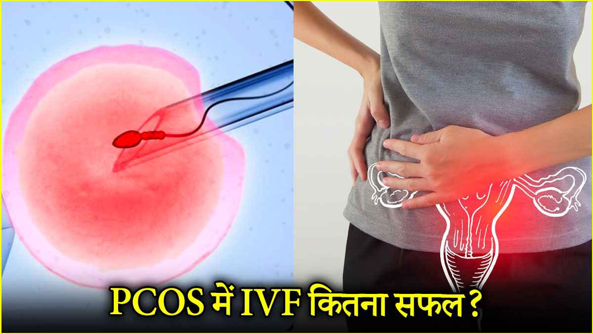 PCOS