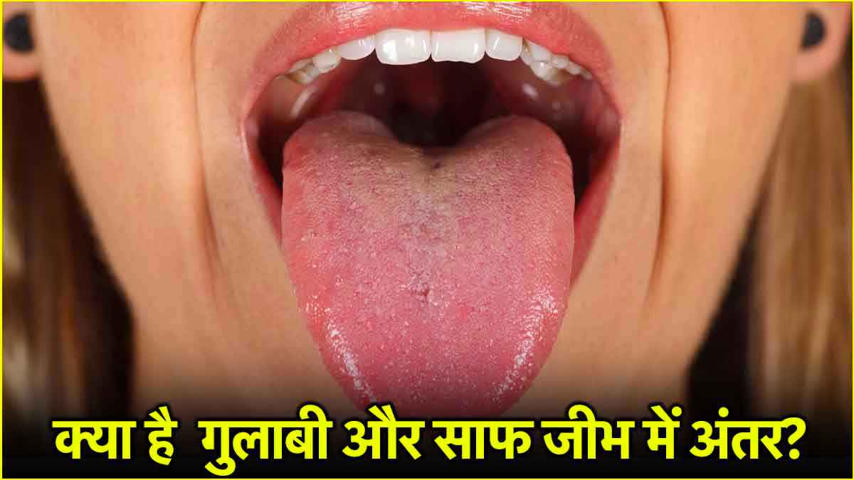 TONGUE SIGNS