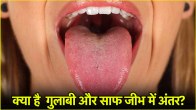 TONGUE SIGNS