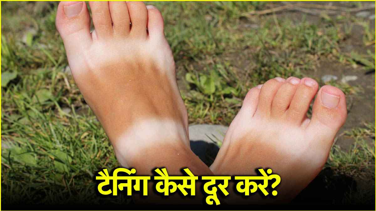 Summer Tips: पैरों की टैनिंग और चप्पलों के निशानों से ऐसे पाएं छुटकारा