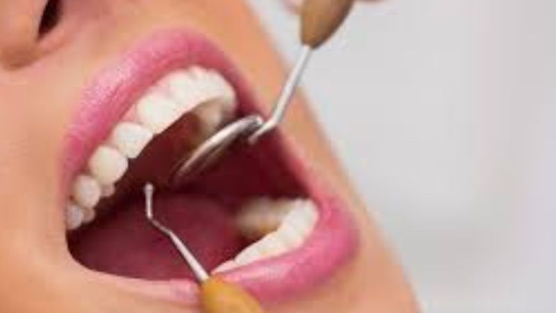 Dental Health Tips