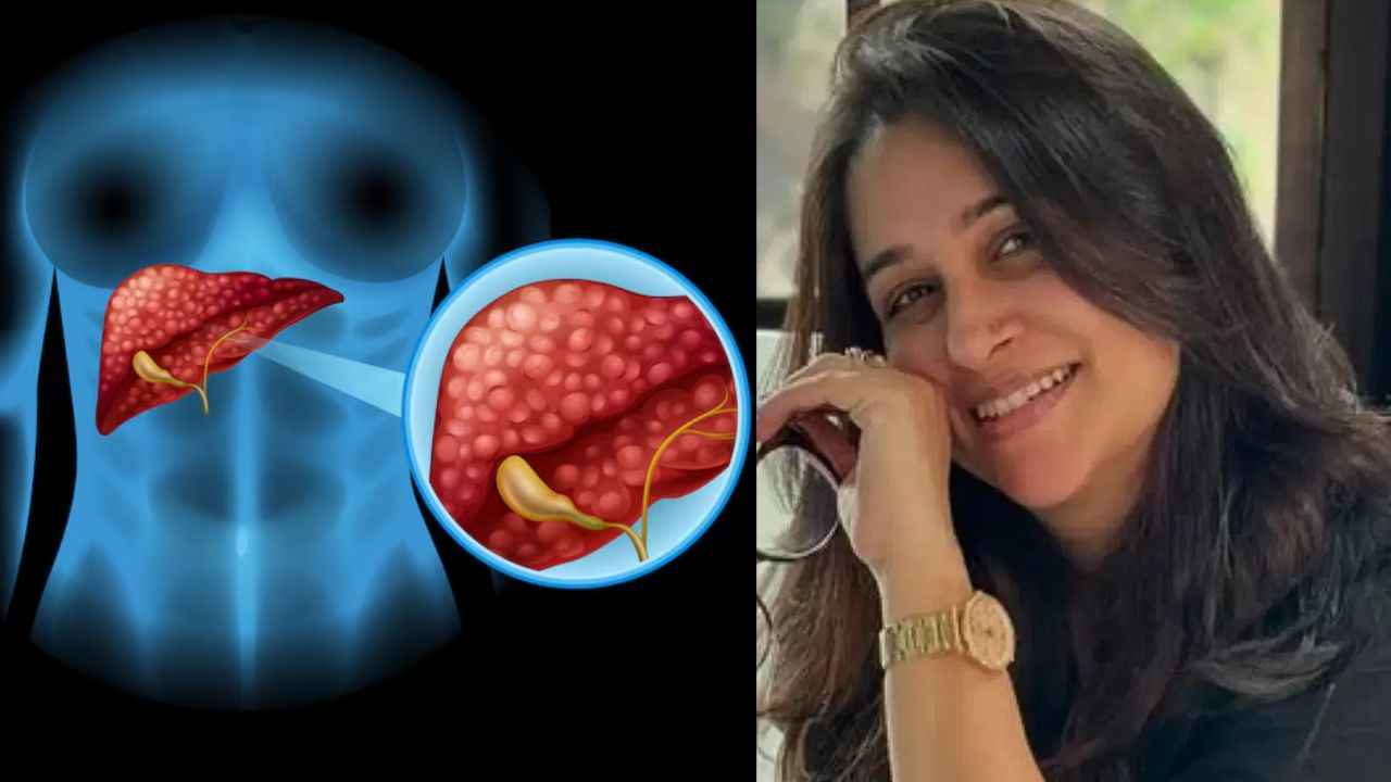 Liver Cancer: दीपिका कक्कड़ का सेकंड स्टेज कैंसर कितना खतरनाक? क्या है शुरुआती संकेत और इलाज