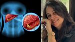 Liver Cancer