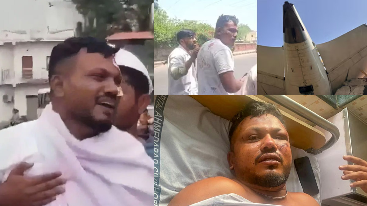 प्लेन क्रैश में जीवित बचे विश्वास हुए डिस्चार्ज, ठुकरा दी एअर इंडिया की ये पेशकश