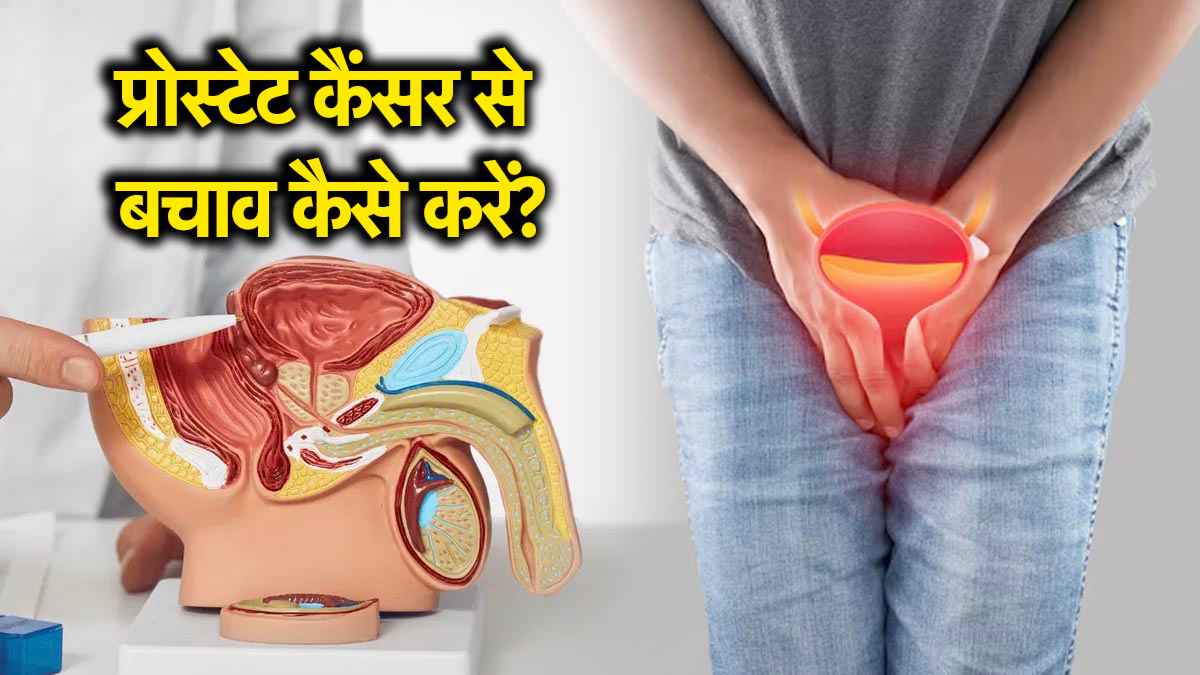 Cancer Causes: पुरुषों में क्यों बढ़ा प्रोस्टेट कैंसर का खतरा, क्या है शुरुआती संकेत और बचाव के तरीके
