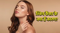 Skin Cancer Causes