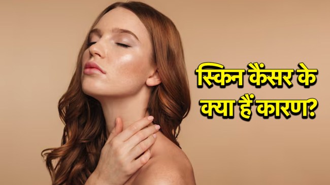 Skin Cancer Causes Skin Cancer Causes