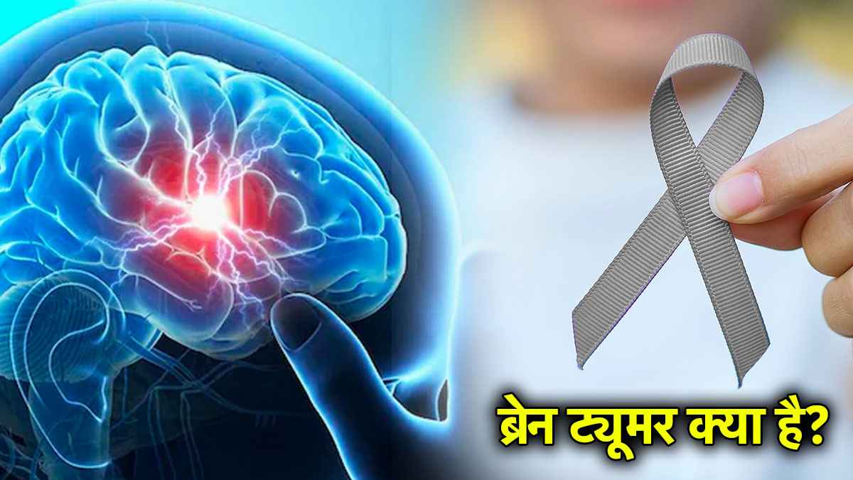 Source: News 24