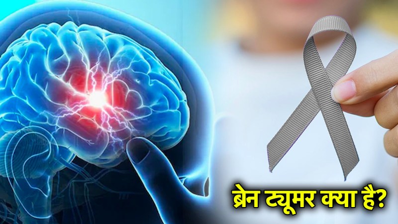 Source: News 24