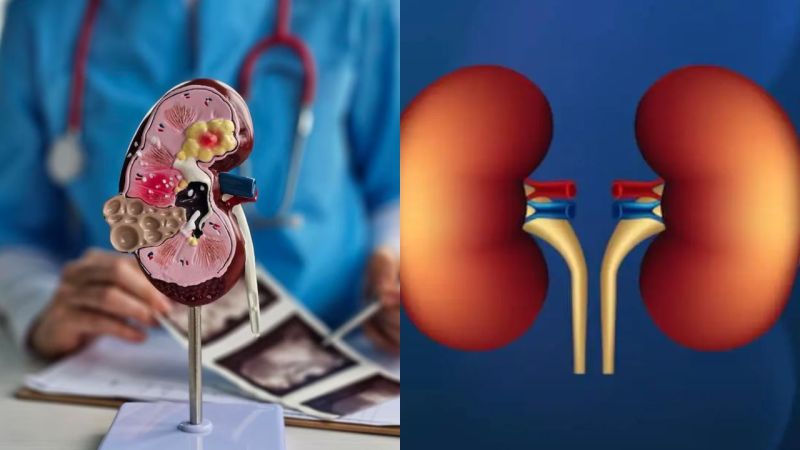 Kidney Diseases