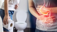 Constipation Remedies