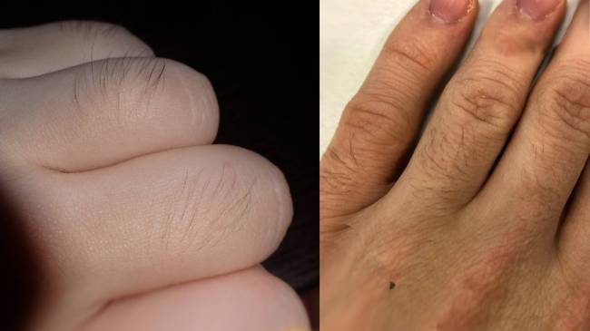 hairs-on-fingers-samudrik-shastra