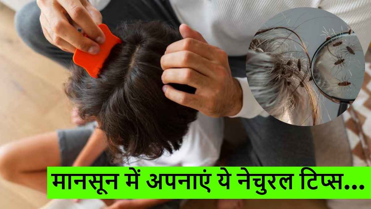 Hair Care Tips: मानसून में जुओं को दूर भगाएंगे ये 5 घरेलू टोटके, पाएं हेल्दी और चमकदार बाल
