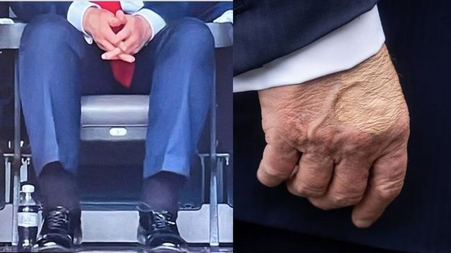 Donald Trump | US President | Health Update